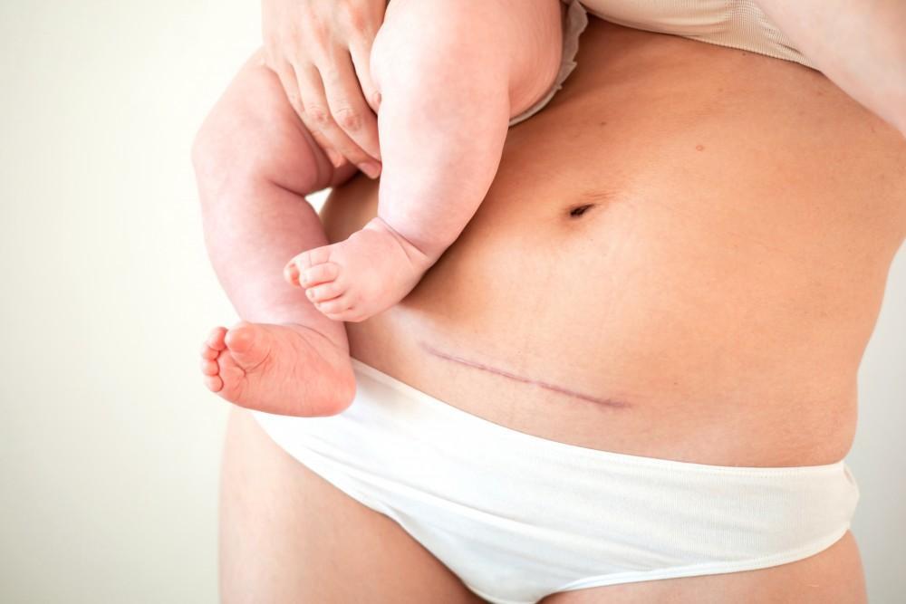 Normal Vaginal Delivery
