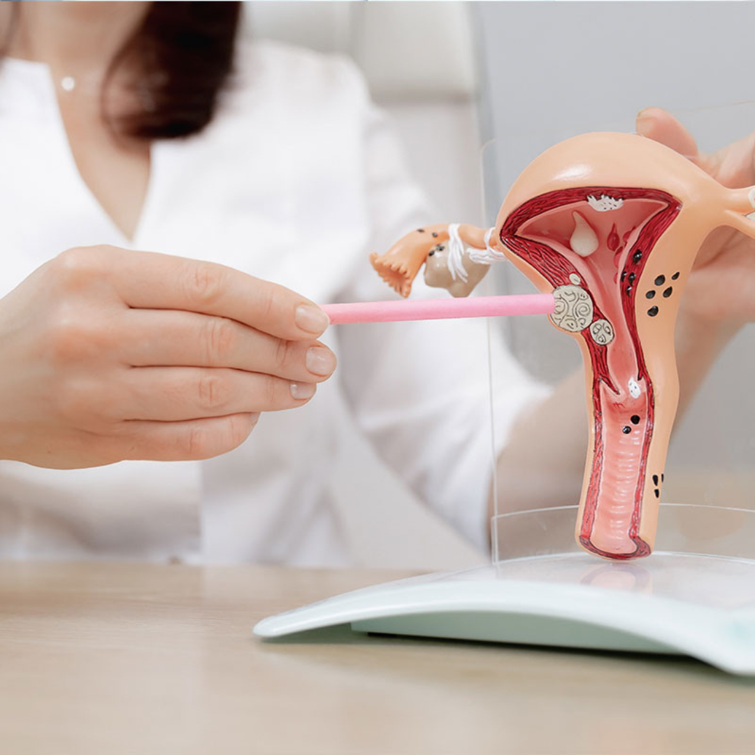 Non-Descent Vaginal Hysterectomy