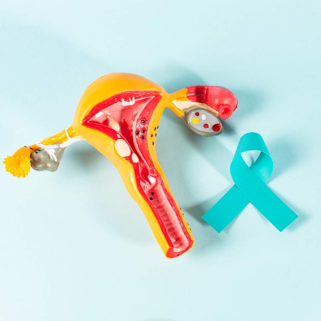 PCOS Treatment