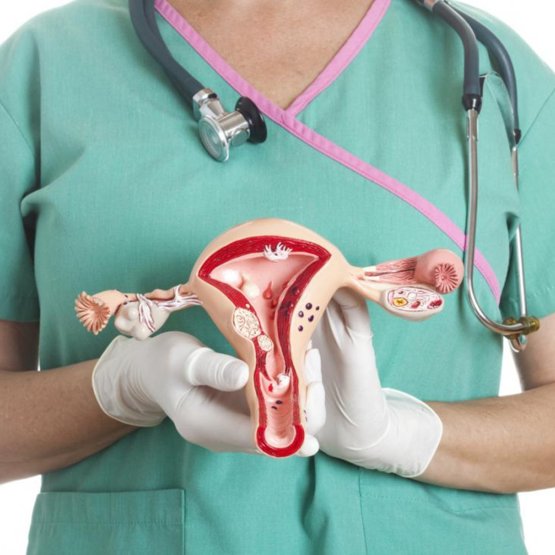 Total Abdominal Hysterectomy
