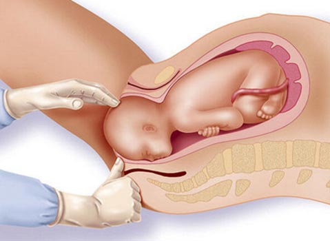 Labor and Delivery
