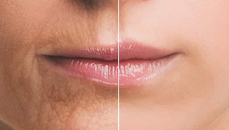 Rejuvenation and Enhancement