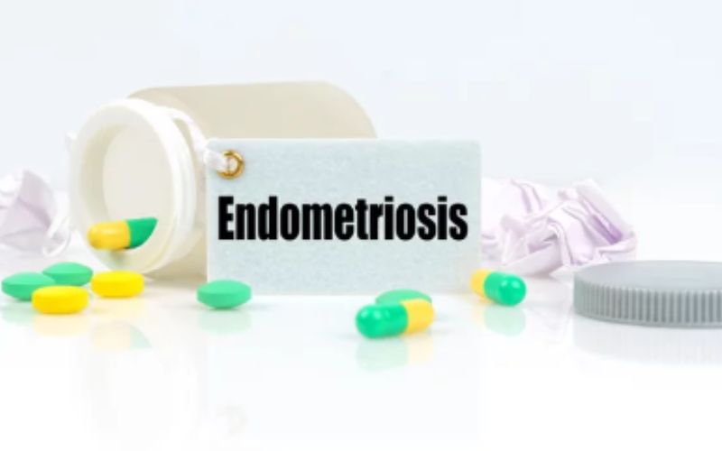 Endometriosis Treatment in Bangalore