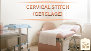 Cervical Stitch (Cerclage)