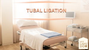 Tubal Ligation