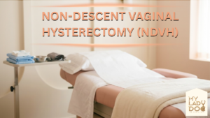 Non-Descent Vaginal Hysterectomy (NDVH)